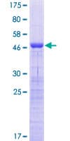 Human CT45A3 Protein (Recombinant GST)