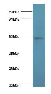 Polyclonal Rabbit anti-Human PRMT2 Antibody (aa1-300, IHC, WB)