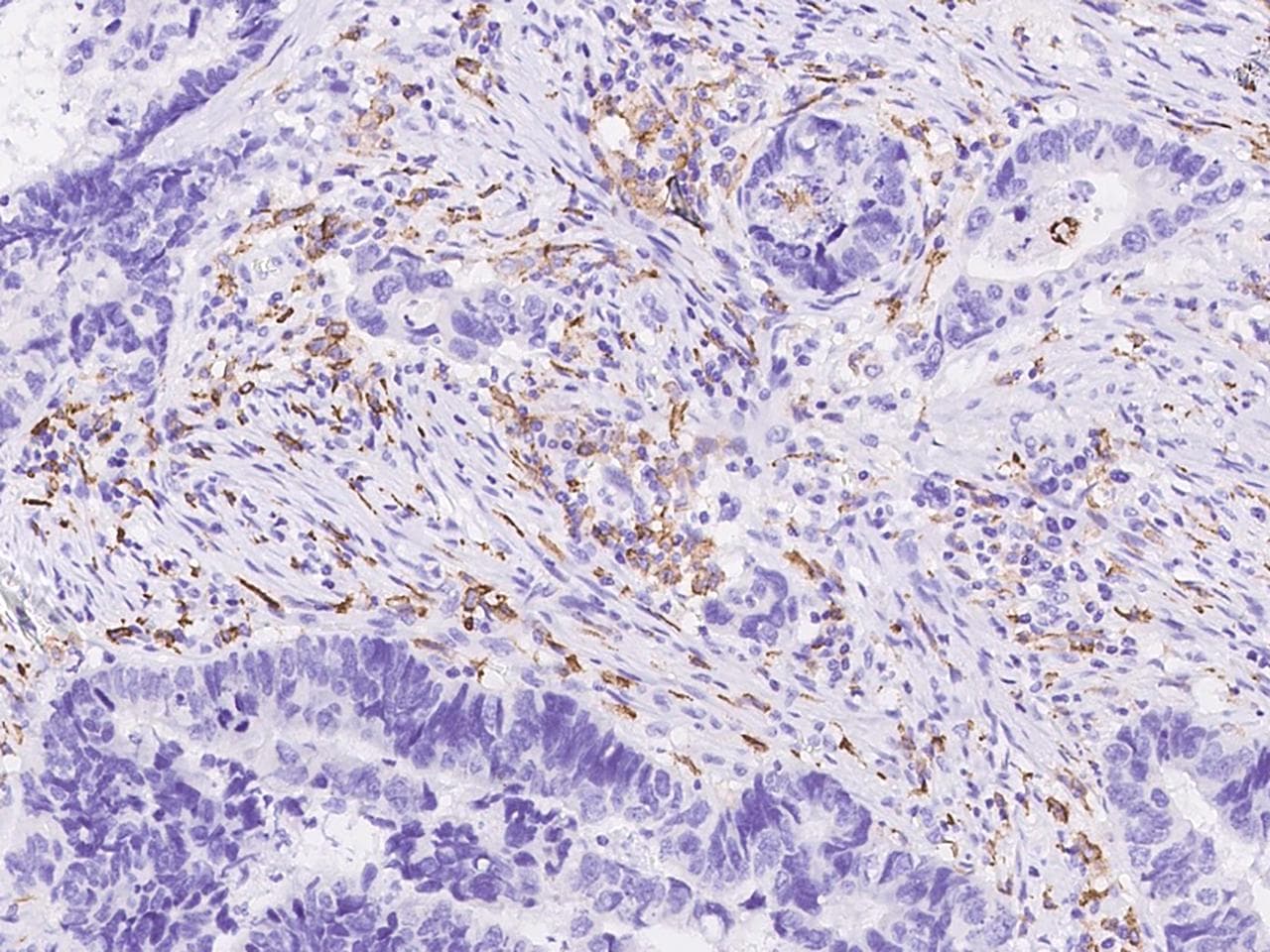 CD163 Antibody