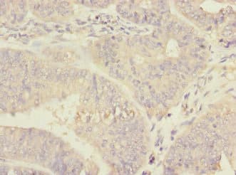 Polyclonal Rabbit anti-Human RPN2 / Ribophorin II Antibody (IHC, WB)