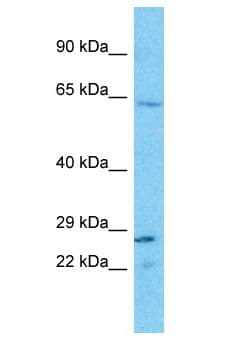TAS2R45 Antibody (aa181-230)