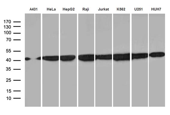 HNRNPH1 / hnRNP H Antibody (clone OTI2E8)