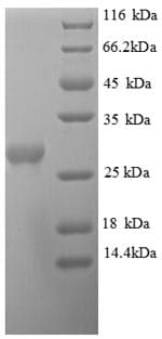H. pylori HP0005 / OMP Decarboxylase Protein (Recombinant 6His, N-terminus)