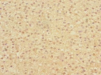 Polyclonal Rabbit anti-Human ERVFRD-1 / HERV-FRD Antibody (IHC)