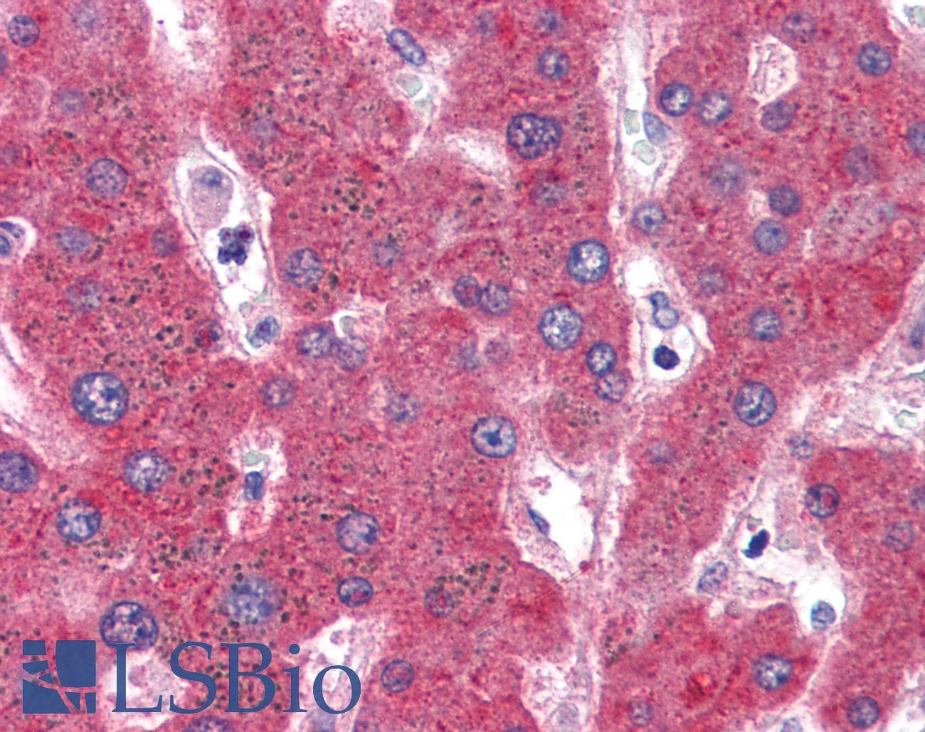 IHC-plus™ SERPINF2 / Alpha-2-Antiplasmin Antibody (aa454-468)