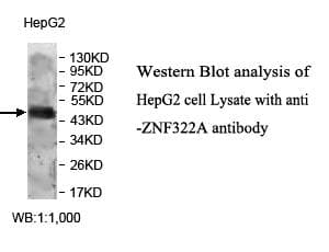 Polyclonal Rabbit anti-Human ZNF322 Antibody (aa139-402, WB)