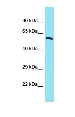 Polyclonal Rabbit anti-Human DUS3L Antibody (aa44-93, WB)