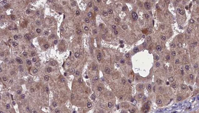 SSTR2 Antibody