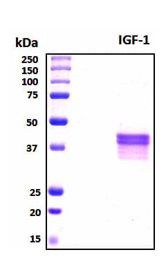 Human IGF1 Protein (Recombinant 6His, N-terminus + Mouse IgG Fc, C-terminus)
