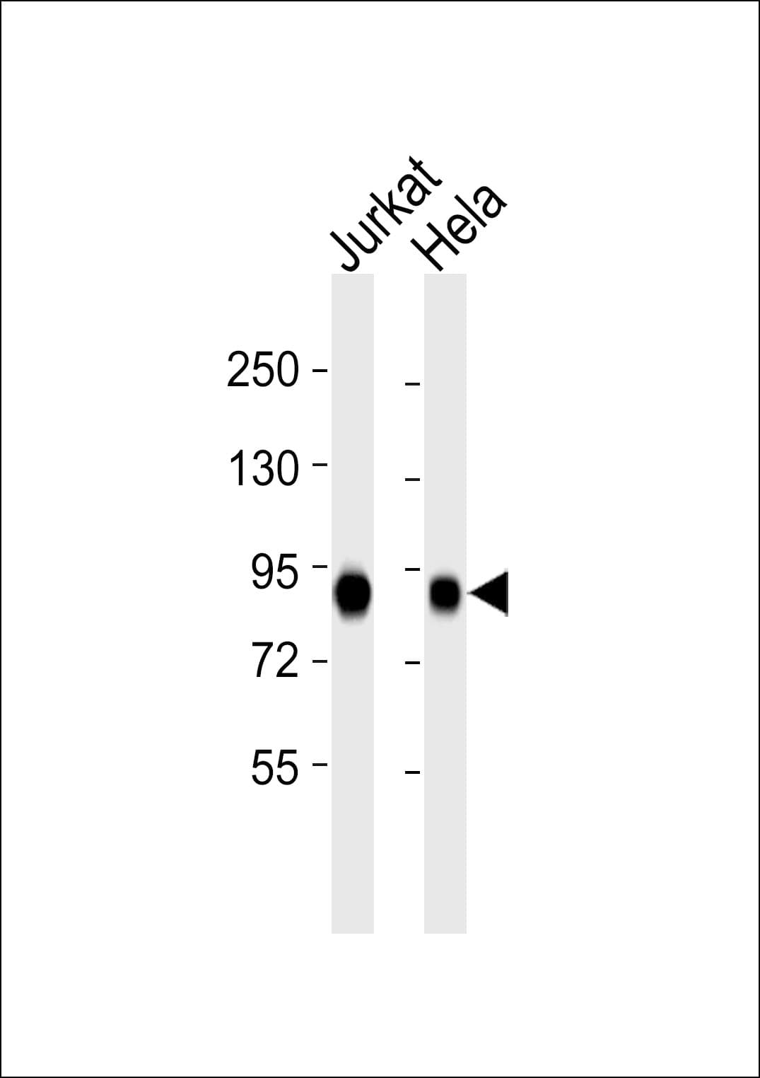 Polyclonal Rabbit anti-Human MYST2 / HBO1 Antibody (WB)