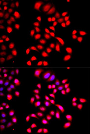 PathPlus™ Polyclonal Rabbit anti-Human CFL2 / Cofilin 2 Antibody (IHC, IF, WB)