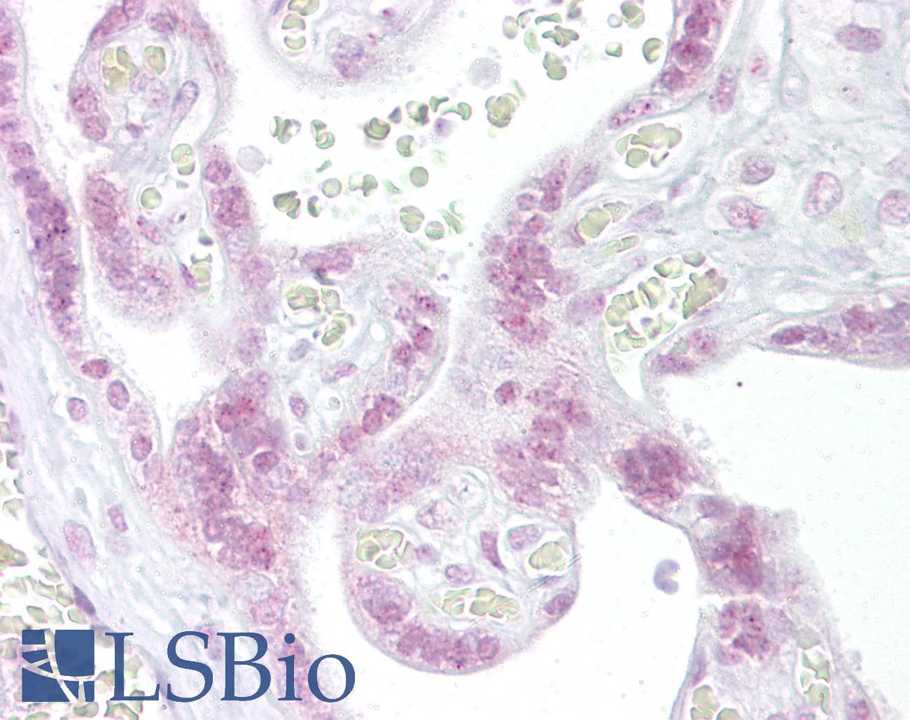 CHEK2 / CHK2 Antibody (N-Terminus)