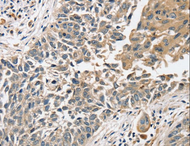 IHC-plus™ Polyclonal Rabbit anti-Human SLC8A3 / NCX3 Antibody (IHC)
