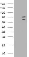 Monoclonal Mouse anti-Human KIAA0517 / TRIM2 Antibody (clone OTI2B10, WB)