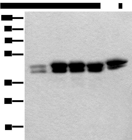 Polyclonal Rabbit anti-Human TIA-1 Antibody (IHC, WB)