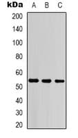 PathPlus™ Monoclonal Mouse anti-Human KRT7 / CK7 / Cytokeratin 7 Antibody (IHC, WB)