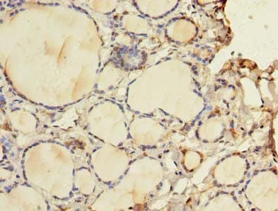 WDR49 Antibody