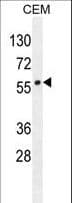 Polyclonal Rabbit anti-Human LIPC / Hepatic Lipase Antibody (aa9-36, WB)