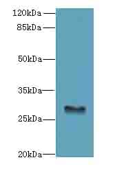 GPM6B Antibody