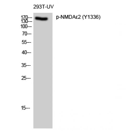 GRIN2B / NMDAR2B / NR2B Antibody (1270-1350 aa)