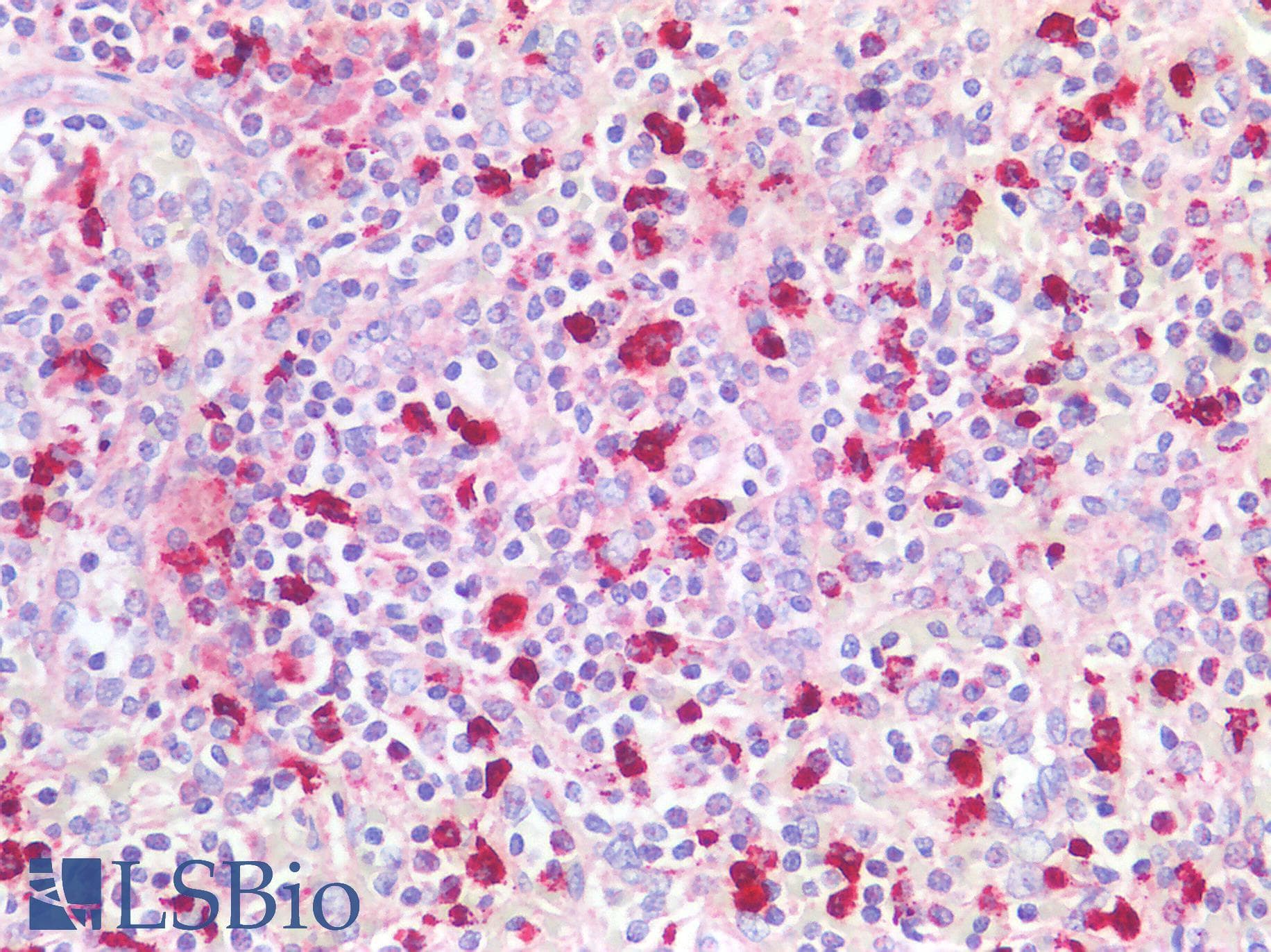 HNE / Neutrophil Elastase Antibody (aa30-247)