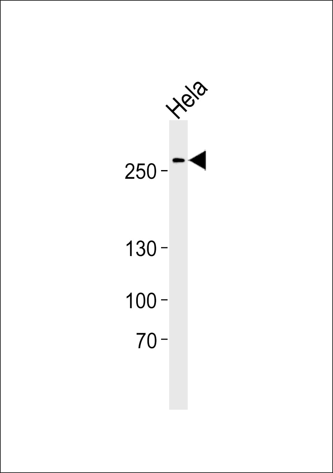 AHCTF1 / ELYS Antibody (Ser1232)