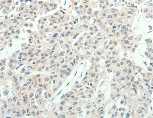 RPAP3 / FLJ21908 Antibody
