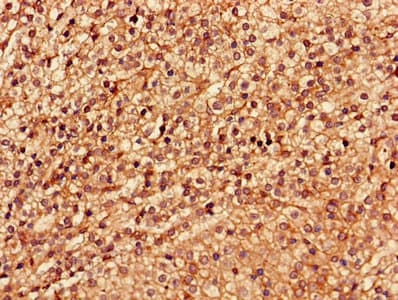 Polyclonal Rabbit anti-Human LSM4 Antibody (aa1-139, IHC, WB)