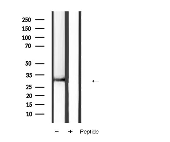Polyclonal Rabbit anti-Human FASLG / Fas Ligand Antibody (IHC, WB)