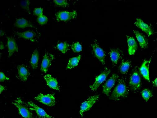 BACE1 / BACE Antibody