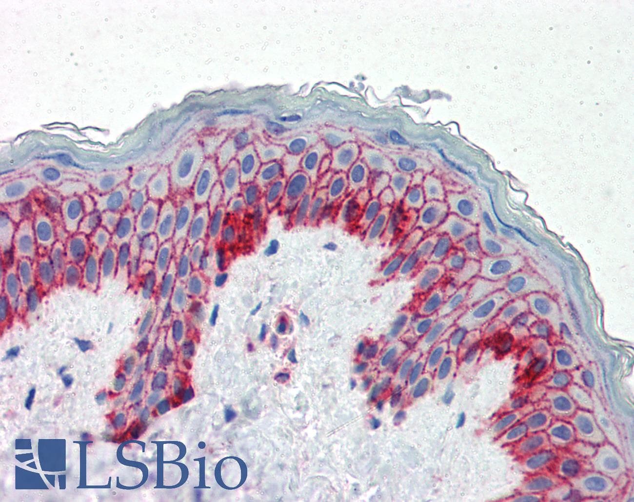 IHC-plus™ B2M / Beta 2 Microglobulin Antibody (clone 2213)