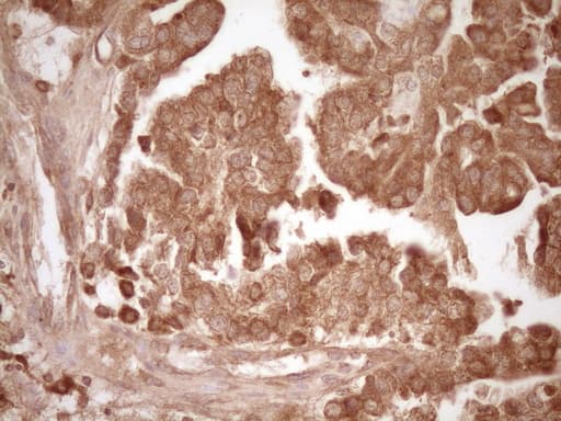 Monoclonal Mouse anti-Human MMP3 Antibody (clone OTI1E9, aa246-477, IHC, WB)