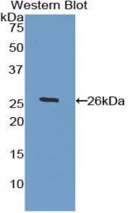 HPSE / Heparanase Antibody (aa54-278, Cy3)