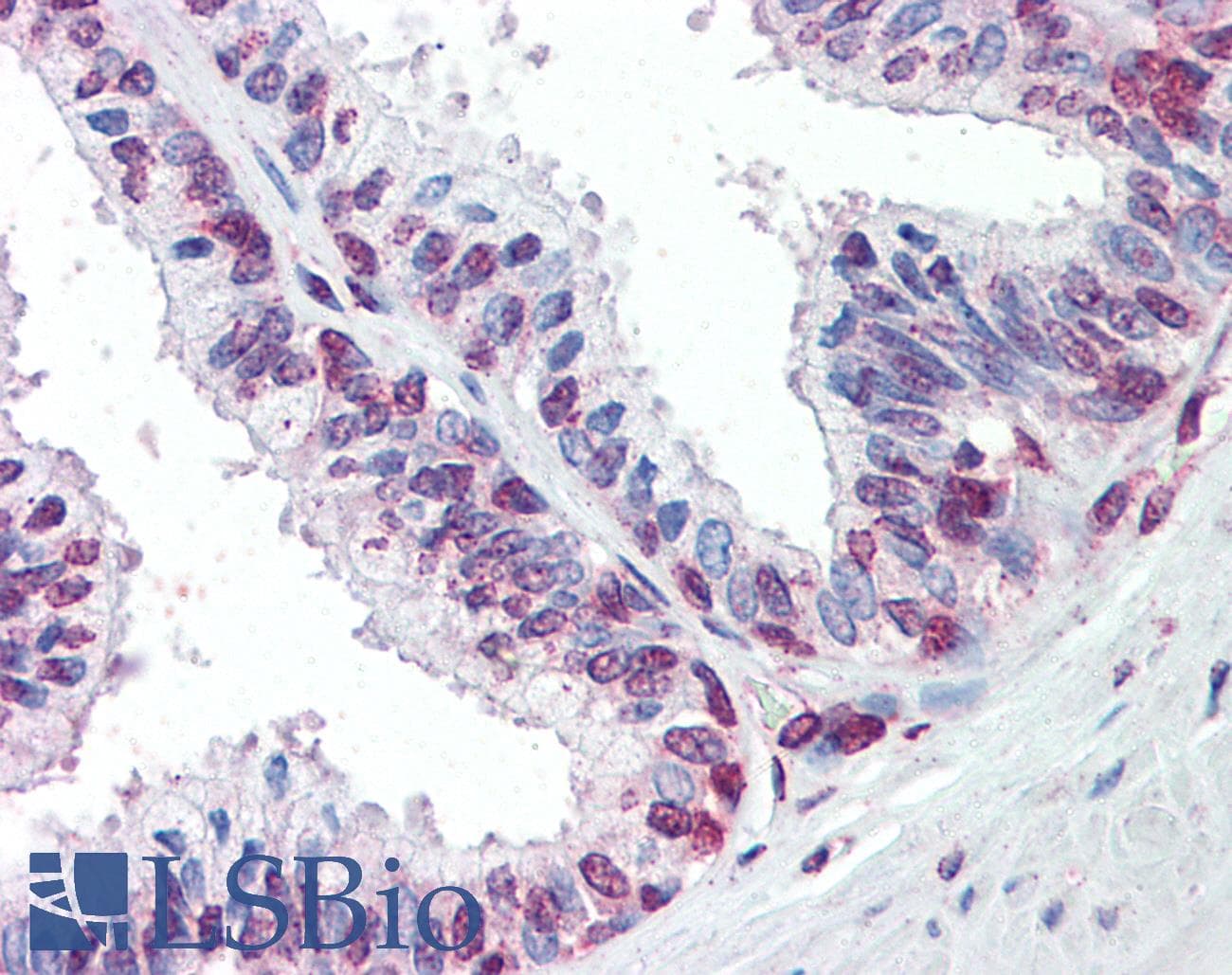 IHC-plus™ ZIC3 Antibody (aa178-189)