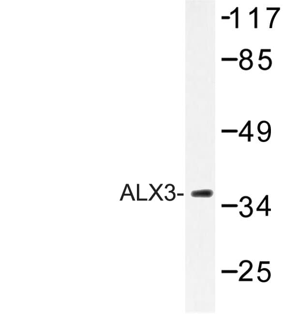 ALX3 Antibody (Arg203)