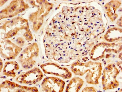 Polyclonal Rabbit anti-Human SERPINA6 / CBG Antibody (WB)