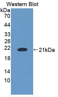OSTM1 Antibody (PE)