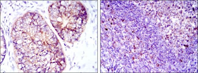 EEF2 / Elongation Factor 2 Antibody (clone 5B6)