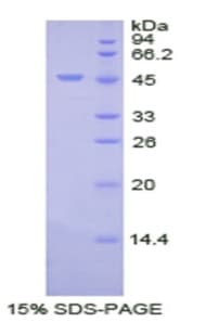 Human PROC / Protein C (Recombinant His)