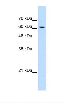 Polyclonal Rabbit anti-Human KIAA0319 Antibody (aa151-200, IHC, WB)