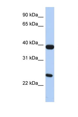 BOB / GPR15 Antibody (aa71-120)