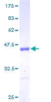 Human LSM5 Protein (Recombinant GST)