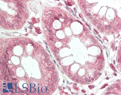 IHC-plus™ Dystonin / BPAG1 Antibody