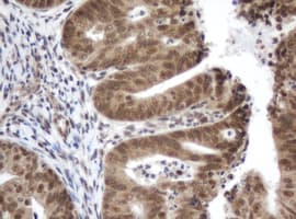 ZIM2 Antibody (clone OTI6D12)