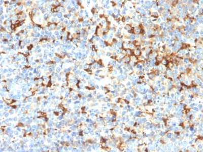 Recombinant Monoclonal Rabbit anti-Human TYRP1 / gp75 Antibody (clone TYRP1/2340R, Azide-free,Carrier-free, aa 257-377, IHC)