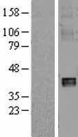 Human NDUFA10 Protein (Over-Expression Lysate Myc-DDK (Flag))
