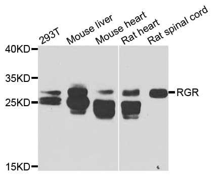 Polyclonal Rabbit anti-Human RGR Antibody (IHC, WB)
