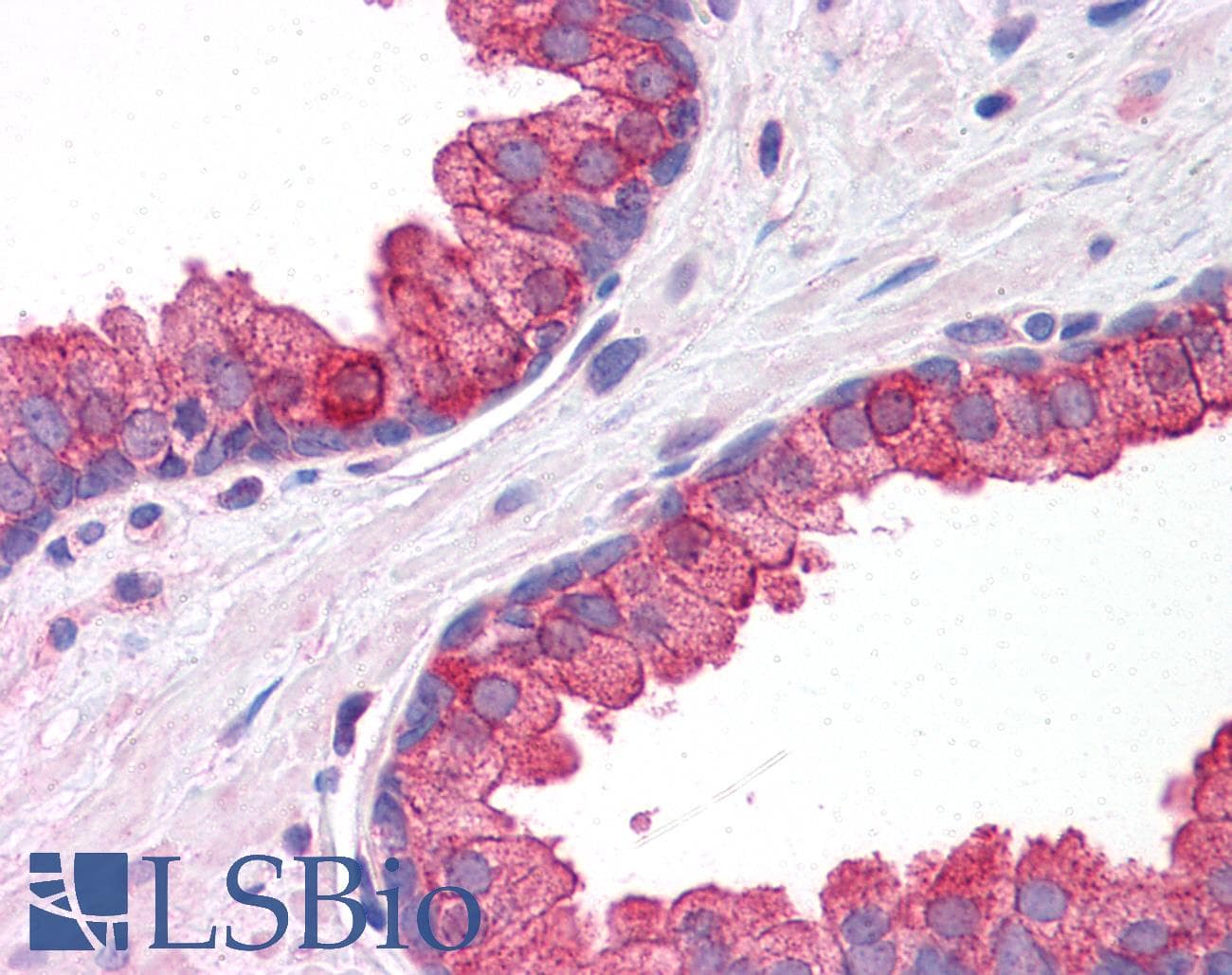 IHC-plus™ KLHL15 Antibody