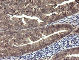 Monoclonal Mouse anti-Human PIK3R5 Antibody (clone OTI4G9, IHC, IF, WB)