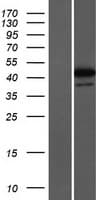 ZNF771 Protein (Over-Expression Lysate Myc-DDK (Flag))